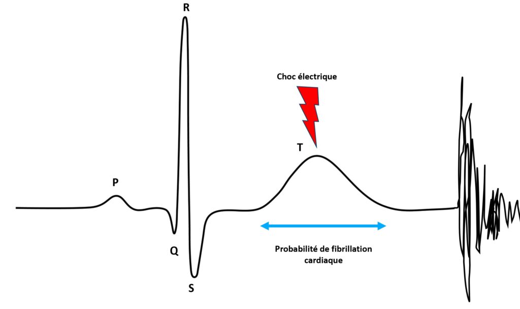 Cycle cardiaque et période vulnérable d’un choc électrique (onde T)