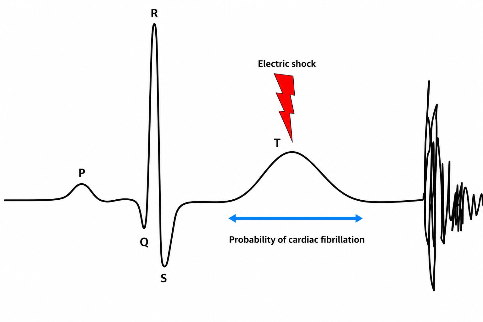 Cardiac cycle and vulnerable period for an electric shock (T wave)